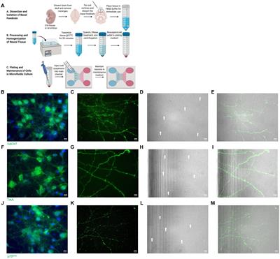 Age-induced nitrative stress decreases retrograde transport of proNGF via TrkA and increases proNGF retrograde transport and neurodegeneration via p75NTR